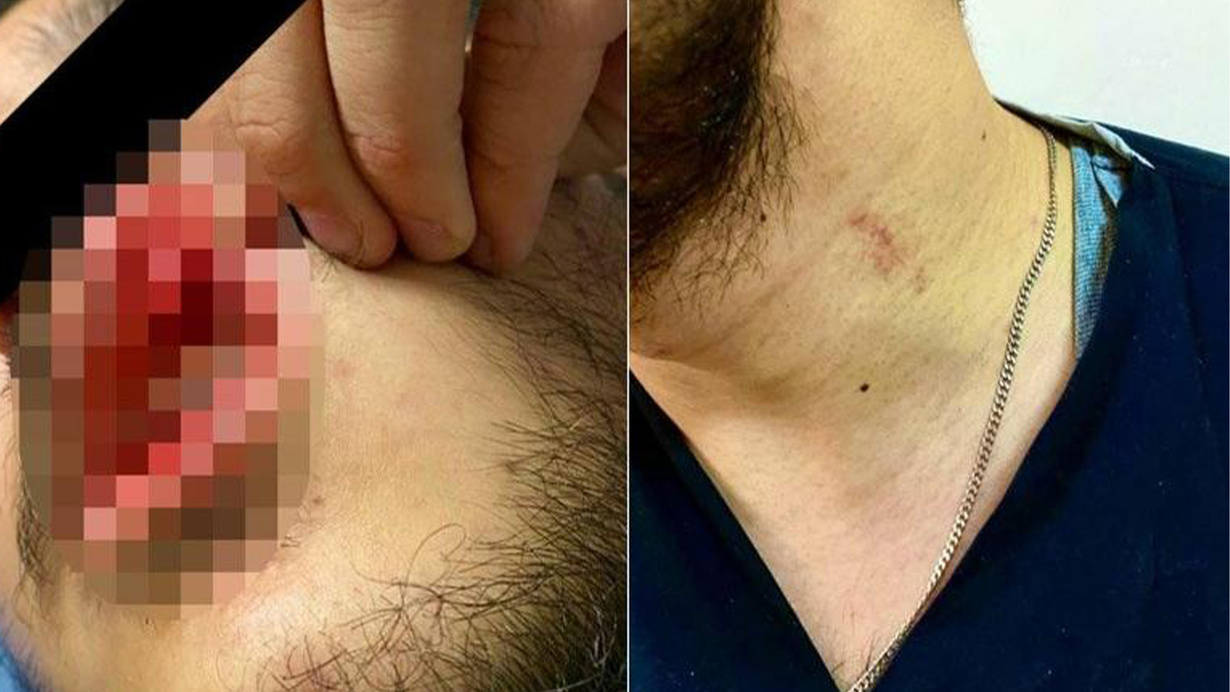 Hastanede dehşet! Sağlık çalışanına tekme tokat saldırdı