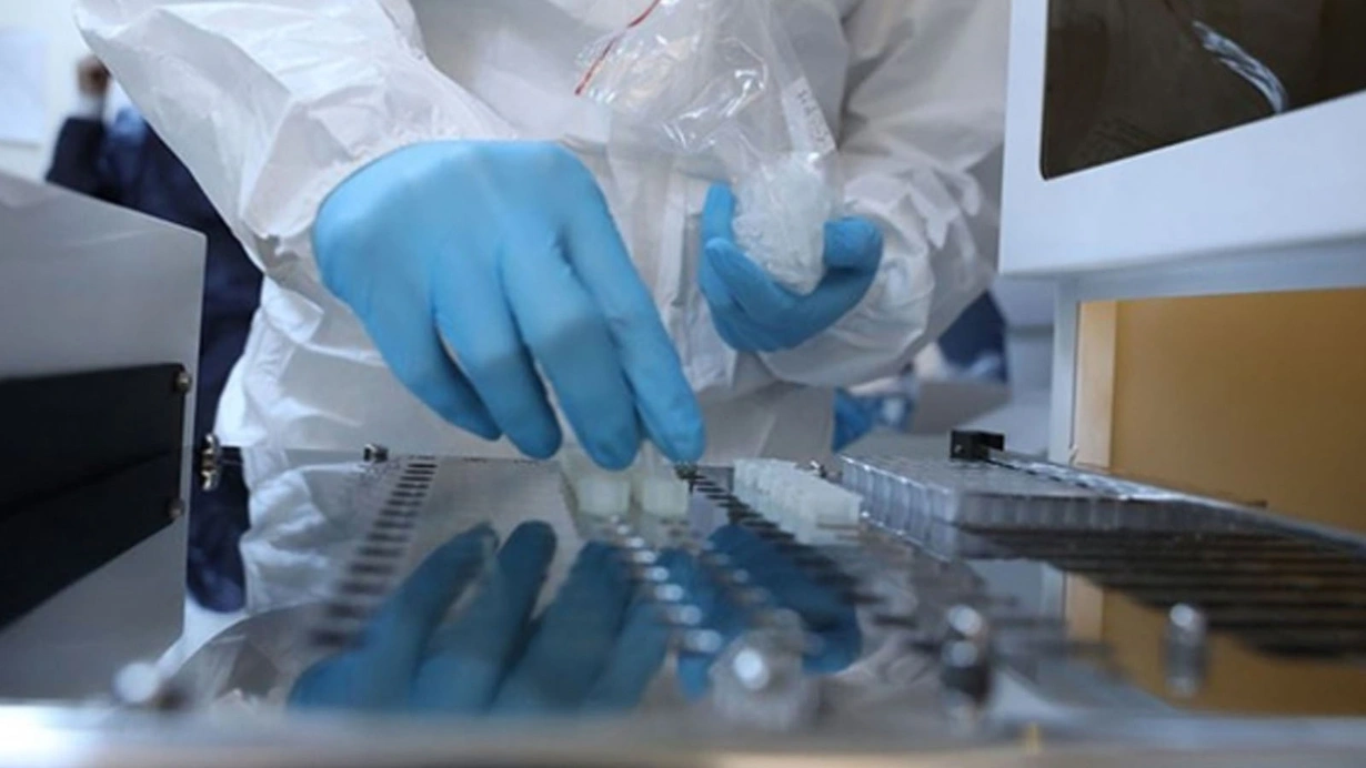 Koronavirüsle ilgili bir çarpıcı sonuç daha! Dişinde iltihap olanlar Kovid-19’u daha ağır geçiriyor