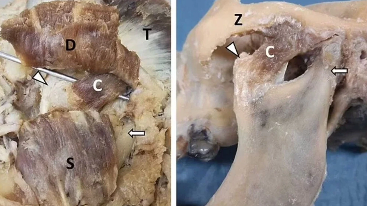 İnsan vücudunda yeni bir kas tabakası keşfedildi