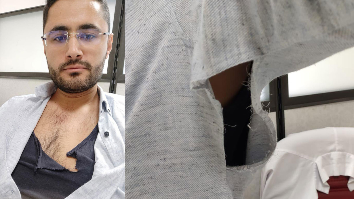 Nevşehir Devlet Hastanesi’nde doktora randevu sırası nedeniyle darp