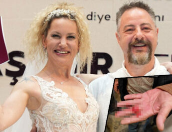 Yıldız Asyalı’nın büyük çaresizliği… ‘Babam da eşim tarafından darp edildi’